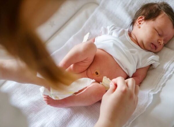 cordão umbilical do bebê